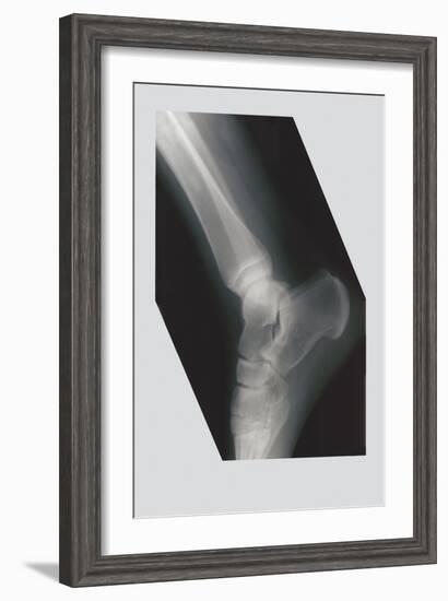 Ankle-null-Framed Art Print