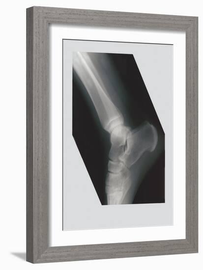 Ankle-null-Framed Art Print