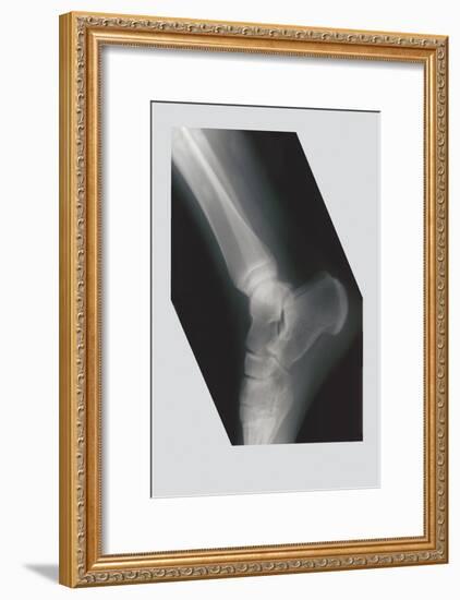 Ankle-null-Framed Art Print