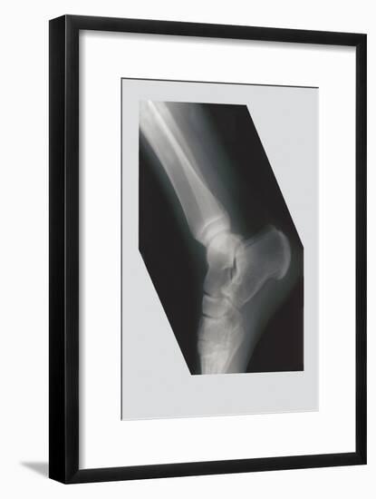 Ankle-null-Framed Art Print