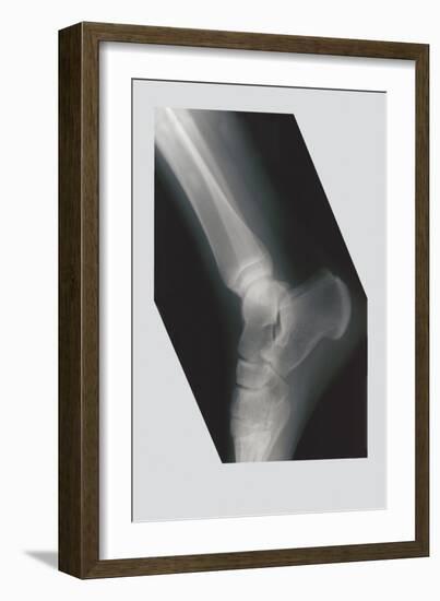 Ankle-null-Framed Art Print