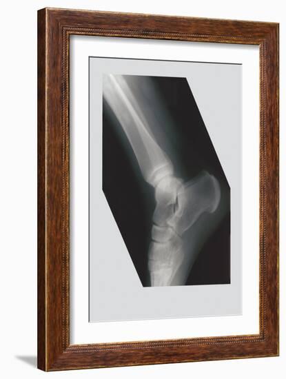Ankle-null-Framed Art Print