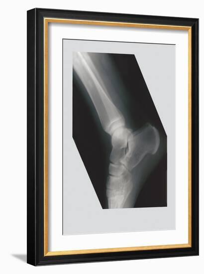 Ankle-null-Framed Art Print