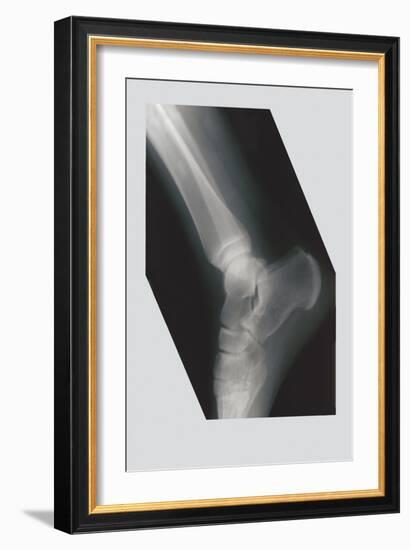 Ankle-null-Framed Premium Giclee Print