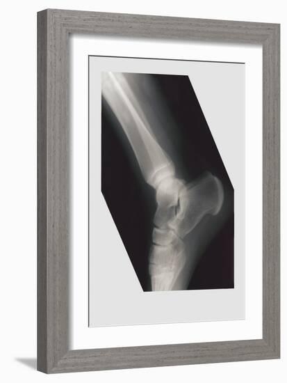 Ankle-null-Framed Premium Giclee Print