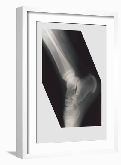 Ankle-null-Framed Premium Giclee Print