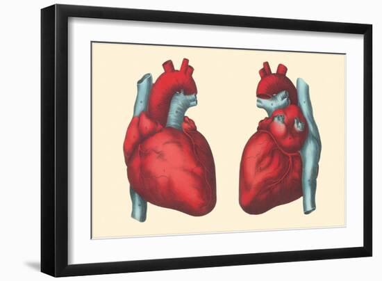 Anterior and Posterior Views of the Heart-Found Image Press-Framed Giclee Print