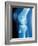 Anterior Cruciate Ligament Repair, X-ray-Miriam Maslo-Framed Photographic Print