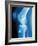 Anterior Cruciate Ligament Repair, X-ray-Miriam Maslo-Framed Photographic Print