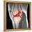 Anterior Cruciate Ligament Tear, CT Scan-Du Cane Medical-Framed Premier Image Canvas