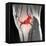 Anterior Cruciate Ligament Tear, CT Scan-Du Cane Medical-Framed Premier Image Canvas