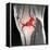 Anterior Cruciate Ligament Tear, CT Scan-Du Cane Medical-Framed Premier Image Canvas