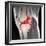 Anterior Cruciate Ligament Tear, CT Scan-Du Cane Medical-Framed Premium Photographic Print