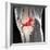 Anterior Cruciate Ligament Tear, CT Scan-Du Cane Medical-Framed Premium Photographic Print