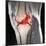 Anterior Cruciate Ligament Tear, CT Scan-Du Cane Medical-Mounted Premium Photographic Print