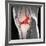 Anterior Cruciate Ligament Tear, CT Scan-Du Cane Medical-Framed Photographic Print