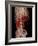 Aortic Aneurysm CT Scan-ZEPHYR-Framed Photographic Print