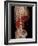 Aortic Aneurysm CT Scan-ZEPHYR-Framed Photographic Print