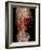 Aortic Aneurysm CT Scan-ZEPHYR-Framed Photographic Print