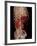 Aortic Aneurysm CT Scan-ZEPHYR-Framed Photographic Print