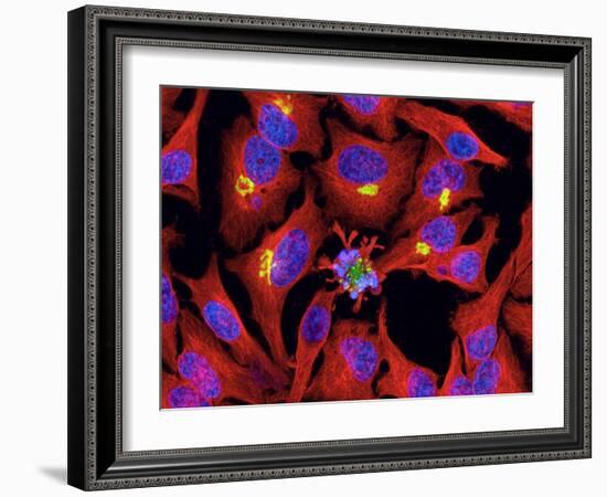 Apoptosis, Fluorescent Light Micrograph-Thomas Deerinck-Framed Photographic Print