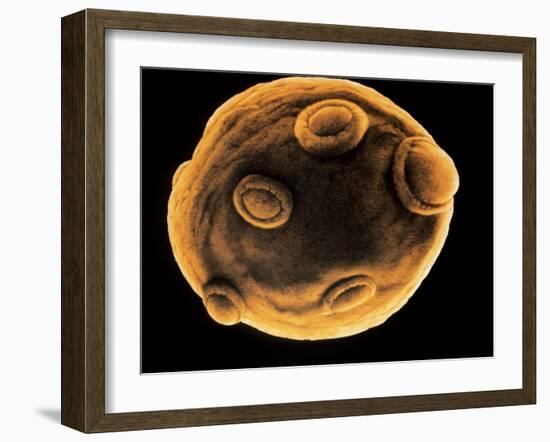 Art of Yeast Cell Budding-Francis Leroy-Framed Photographic Print