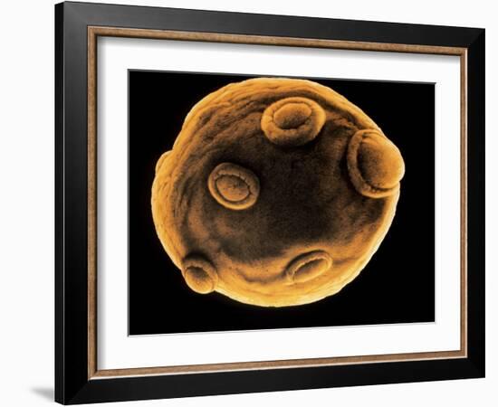 Art of Yeast Cell Budding-Francis Leroy-Framed Photographic Print