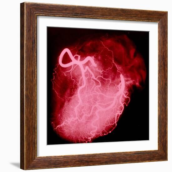 Arteriograph of the Coronary Arteries of the Heart-Science Photo Library-Framed Premium Photographic Print