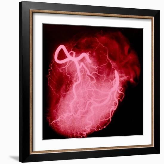 Arteriograph of the Coronary Arteries of the Heart-Science Photo Library-Framed Premium Photographic Print