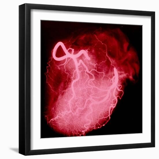 Arteriograph of the Coronary Arteries of the Heart-Science Photo Library-Framed Premium Photographic Print