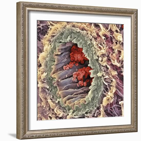 Artery SEM-Steve Gschmeissner-Framed Premium Photographic Print