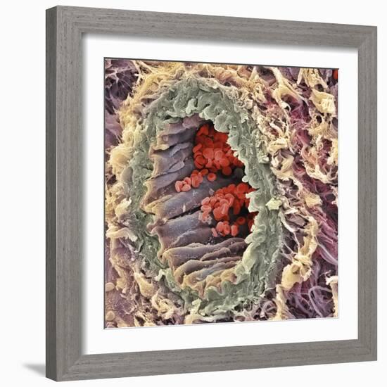 Artery SEM-Steve Gschmeissner-Framed Premium Photographic Print