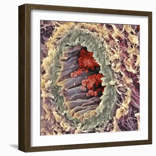 Artery SEM-Steve Gschmeissner-Framed Premium Photographic Print