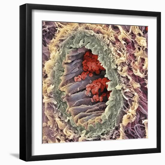 Artery SEM-Steve Gschmeissner-Framed Premium Photographic Print