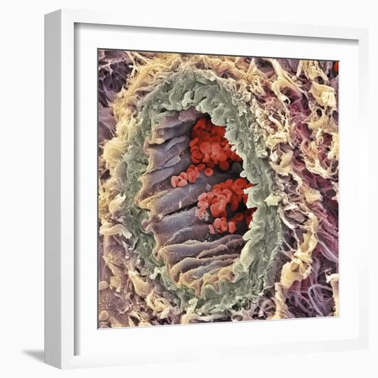 Artery SEM-Steve Gschmeissner-Framed Premium Photographic Print