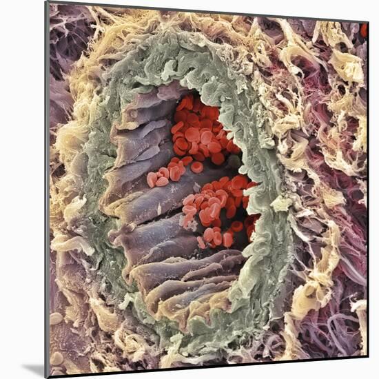 Artery SEM-Steve Gschmeissner-Mounted Premium Photographic Print