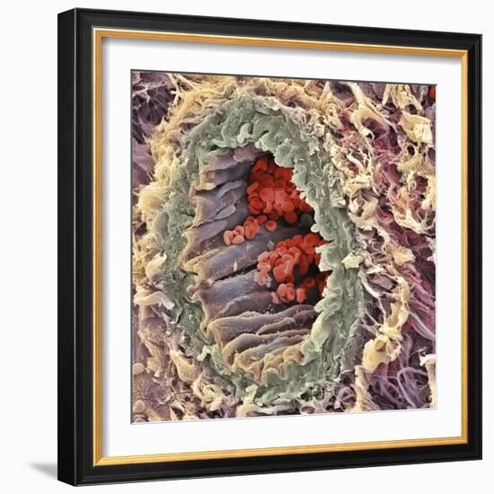 Artery SEM-Steve Gschmeissner-Framed Premium Photographic Print