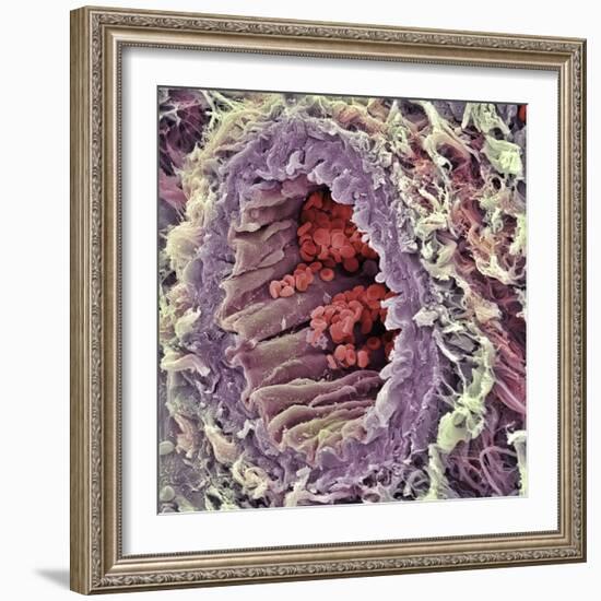 Artery SEM-Steve Gschmeissner-Framed Premium Photographic Print