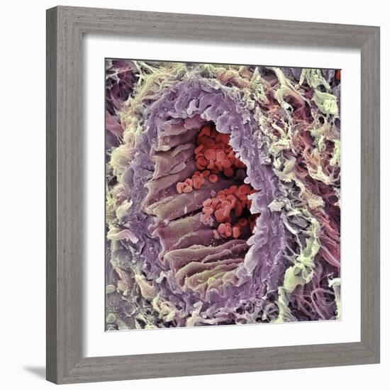 Artery SEM-Steve Gschmeissner-Framed Premium Photographic Print