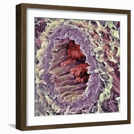 Artery SEM-Steve Gschmeissner-Framed Premium Photographic Print