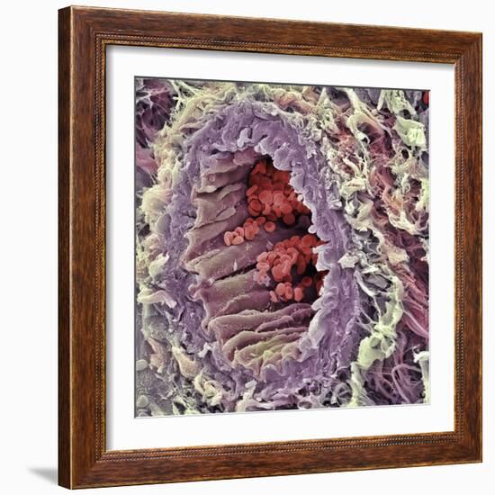 Artery SEM-Steve Gschmeissner-Framed Premium Photographic Print