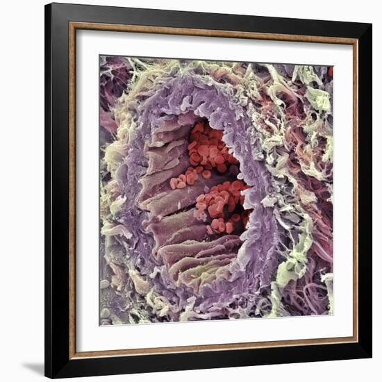 Artery SEM-Steve Gschmeissner-Framed Premium Photographic Print