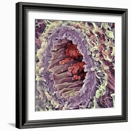 Artery SEM-Steve Gschmeissner-Framed Premium Photographic Print