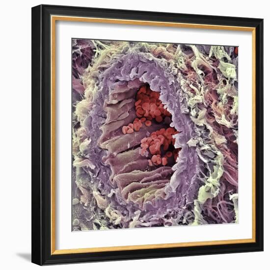 Artery SEM-Steve Gschmeissner-Framed Premium Photographic Print