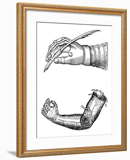 Artificial Limbs, 1510-1590-null-Framed Giclee Print