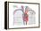 Artificial Pacemaker-Encyclopaedia Britannica-Framed Stretched Canvas