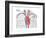 Artificial Pacemaker-Encyclopaedia Britannica-Framed Art Print