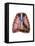 Artist Depiction of Mesothelioma in the Lungs-Abdominal Cavity-null-Framed Stretched Canvas