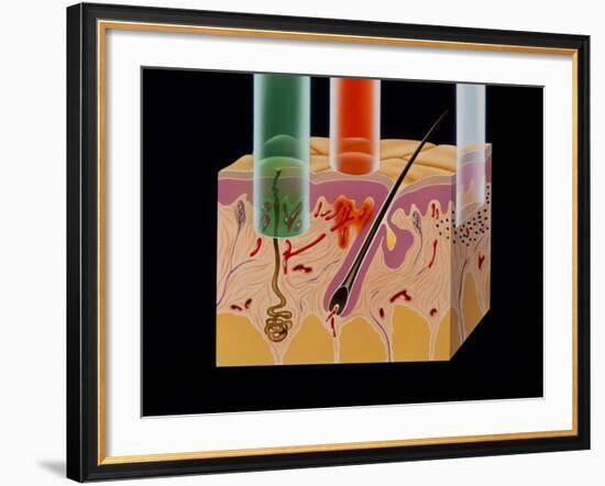 Artwork: Penetration of Skin by Various Lasers-John Bavosi-Framed Photographic Print