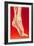 Artwork Showing Calcaneal Spur And Foot Pain-John Bavosi-Framed Photographic Print